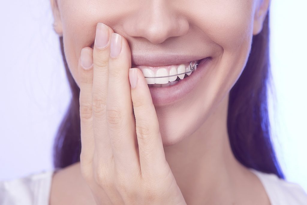 RETENTION Gladesville Orthodontics